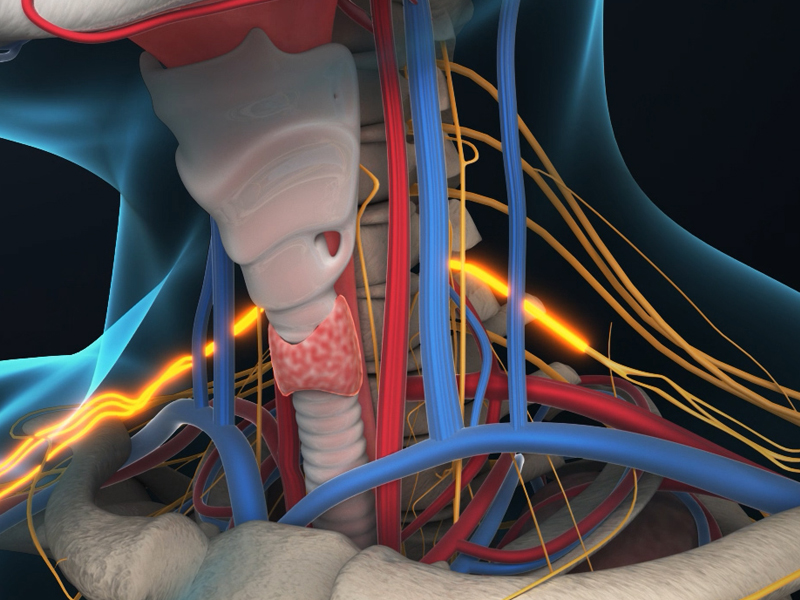 工业事故3d动画_医疗科普动画_mg动画_二维动画制作_医疗手术动画科普_工业类三维动画展示方案